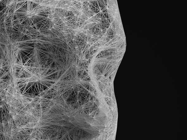 LCU - Complex Craniofacial Clefts