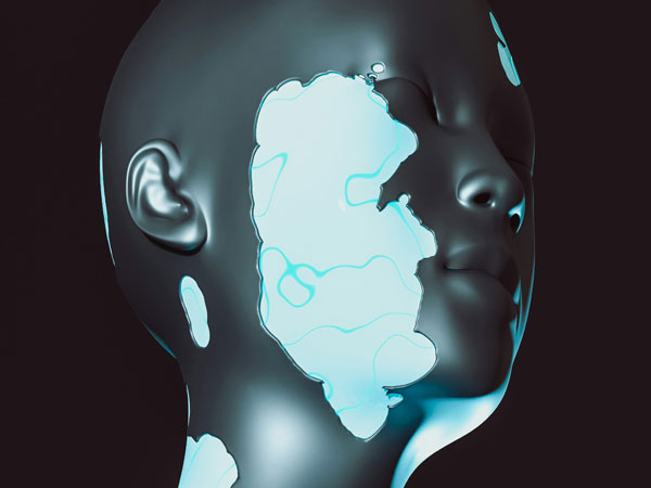 LCU - Craniofacial Dermoid Cyst