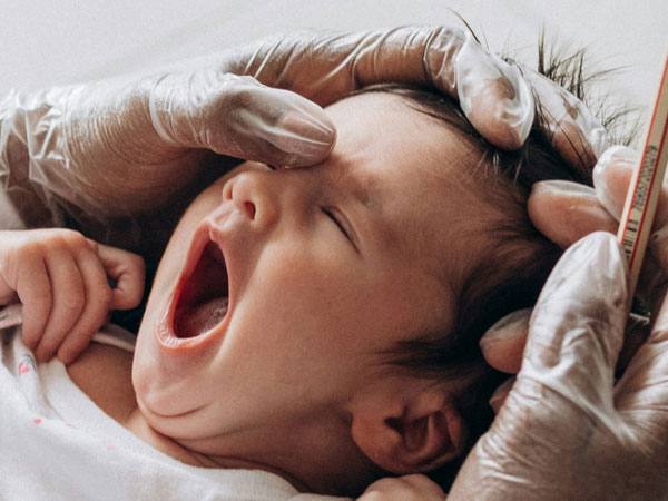 LCU - Metopic Craniosynostosis