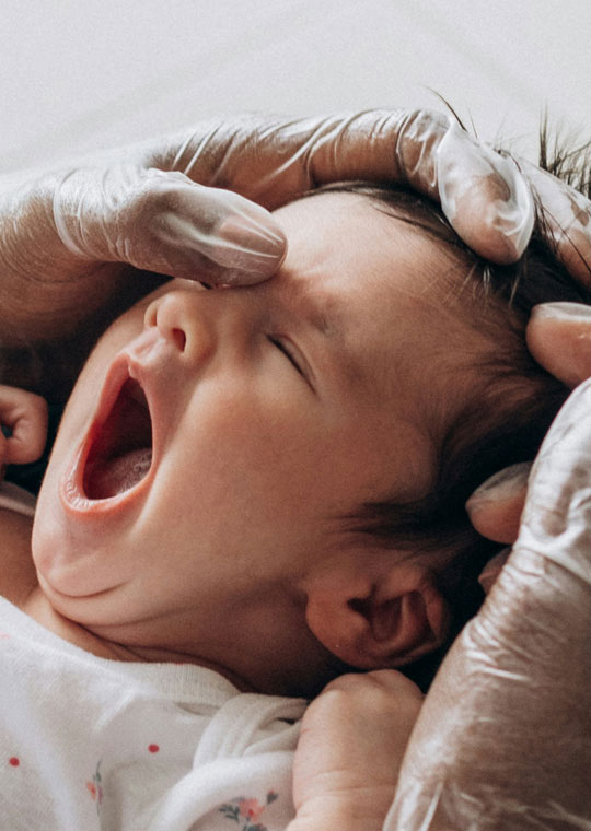 LCU - Metopic Craniosynostosis
