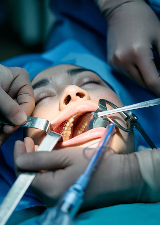 LCU - Oral Surgey