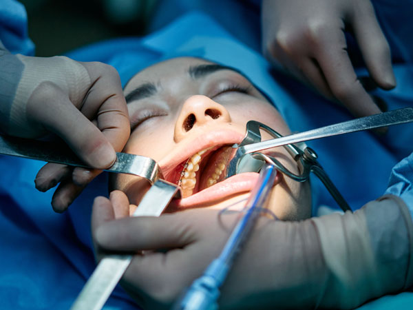 LCU - Oral Surgey