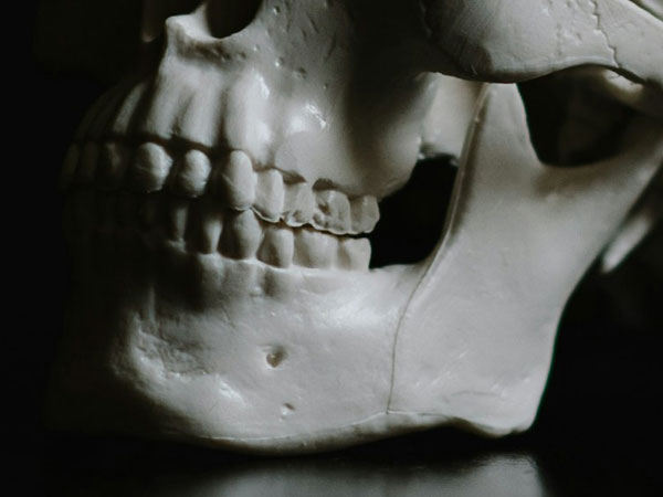 LCU - Orthognathic Surgery