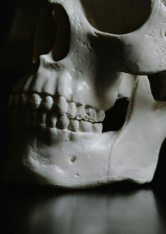 LCU - Orthognathic Surgery
