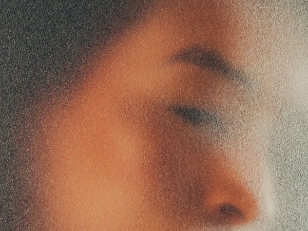 Cosmetic / Aesthetic Treatments - London Craniofacial Unit