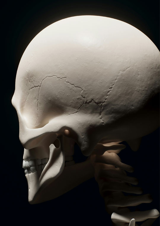 LCU - What is Craniosynostosis